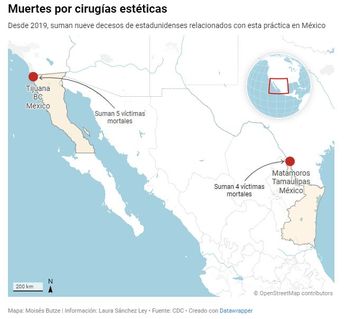 Muertes por cirugías estéticas. | Especial