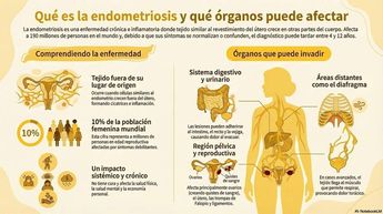 Se han encontrado casos de mujeres con endometriosis hasta en