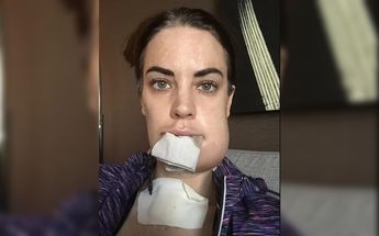 Así se veía el rostro de Elly tras la cirugía / Especial
