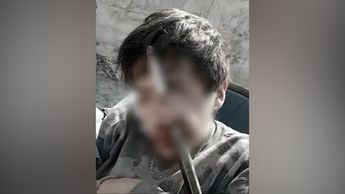 Joven cae de una obra y se atraviesa el rostro en Tláhuac. C4 en Alerta, 20 de febrero de 2026