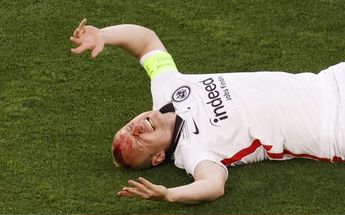Sebastian Rode, defensa del Eintracht, con la herida en la Final de la UEL / Reuters