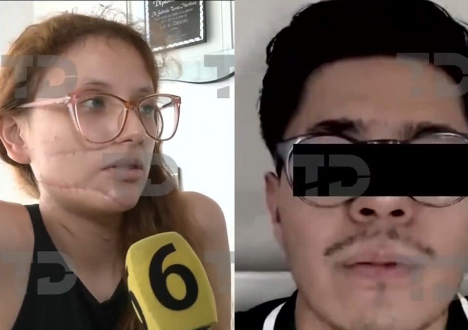 Wendy relata como sobrevivió a un intento de feminicidio por parte de su pareja en Ecatepec. / Telediario