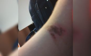El abuelo del menor destacó que las fotos se tomaron como pruebas / Fernando Cruz.