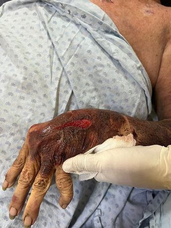 Las lesiones que Carlos solía provocar a su madre requirieron que la mujer tuviera que ser hospitalizada / Especial