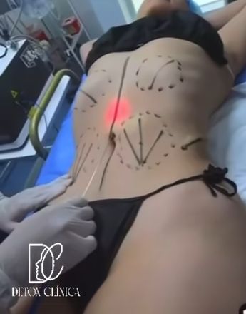 'Detox Clínica' utilizaba videos de procedimientos que no se realizaban en alguna de sus dos direcciones / Facebook: Detox Clínica
