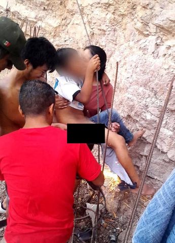 Las maniobras tuvieron que ser quirúrgicas para evitar un daño mayor / Especial