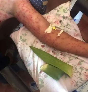Camión cae sobre enjambre de abejas │