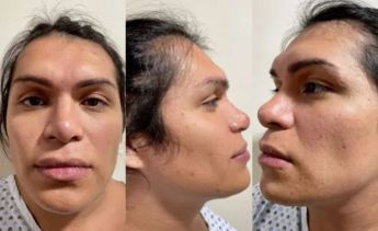 Wendy Guevara antes de cirugías. | Especial