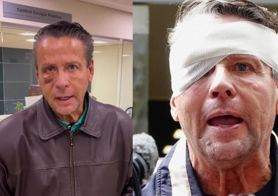 En sus redes sociales se dejó ver minutos después de ser operado.