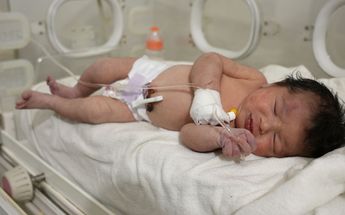 La bebé tiene pequeñas contusiones pero está estable de salud / AFP