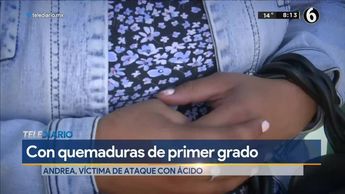 Arrojan ácido a mujer en Puebla; víctima denuncia que ha recibido amenazas