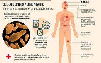 Botulismo | Especial