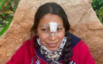 Araceli sufrió un golpe en la nariz durante el choque de trenes en la Línea 3 /Azucena Rangel