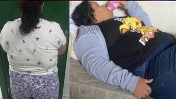 Mujer de 37 años usaba chupones y biberones para fingir ser una niña. / Cortesía Alpha Notícias
