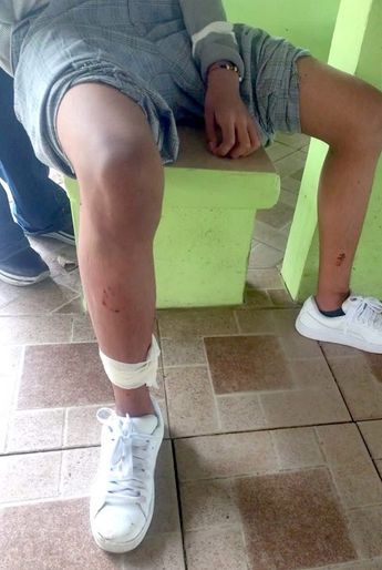 Al menos siete alumnos tuvieron que ser hospitalizados tras presentar heridas profundas / Fluvio César Martínez