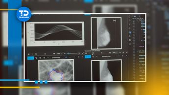 Algoritmos de Inteligencia Artificial trazan vectores para determinar la naturaleza de un tumor / Cortesía