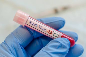 El virus de Nipah suele encontrarse incluso en alimentos / iStock