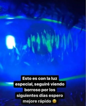 Arturo Islas sufre accidente al inflar un balón