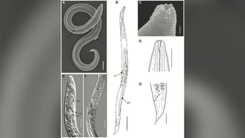 Partes del gusano revivido / Shatilovich et al, 2023, PLOS Genetics, CC-BY 4.0