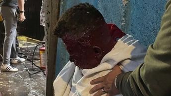 Una persona resultó graves quemaduras en el rostro y cuerpo por la explosión de gas.