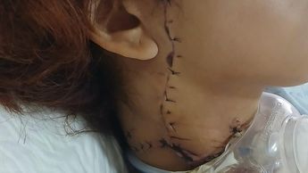 Daniela sufrió heridas de gravedad en el cuello | Especial