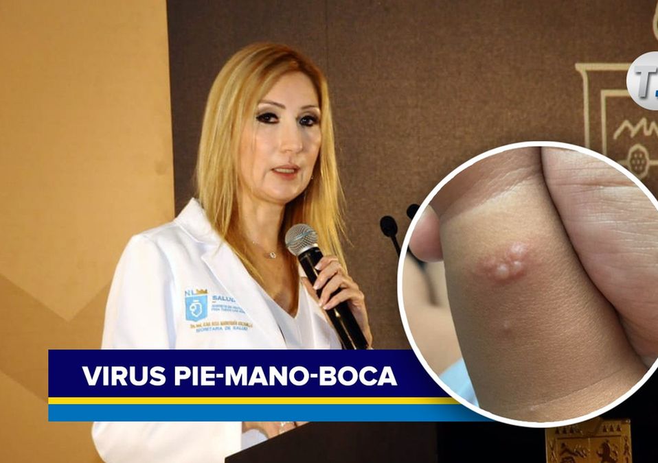 Virus pie, mano, boca en Monterrey | Cortesía