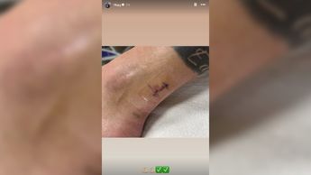 Lesión de Gignac compartida en Instagram / Captura