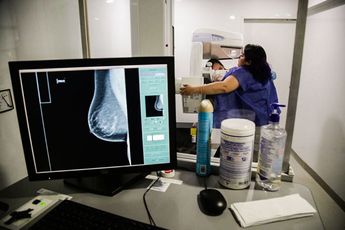 Así se ven los rayos x durante un estudio de mastografía en México / Agencia Cuartoscuro