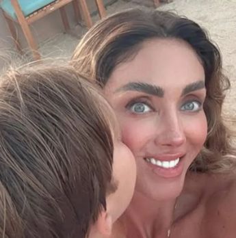 Anahí es duramente criticada por el aspecto de su rostro.