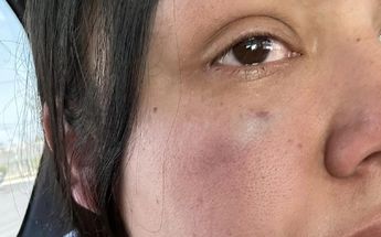 Mujer afectada tras pelea en Escobedo | Especial