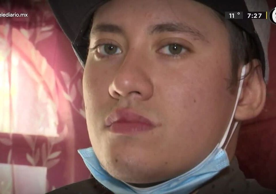 Joven lagunero perdió su brazo en un accidente; pide apoyo para su prótesis