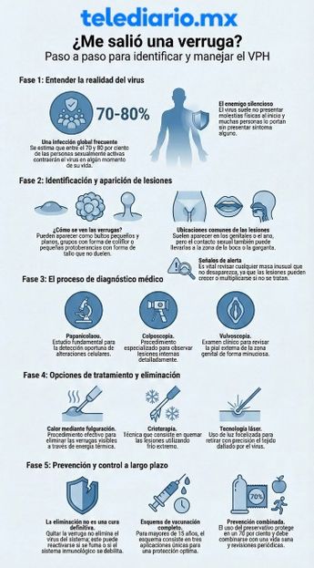 Las verrugas por VPH no duelen | Foto temática generada por IA NotebookLM