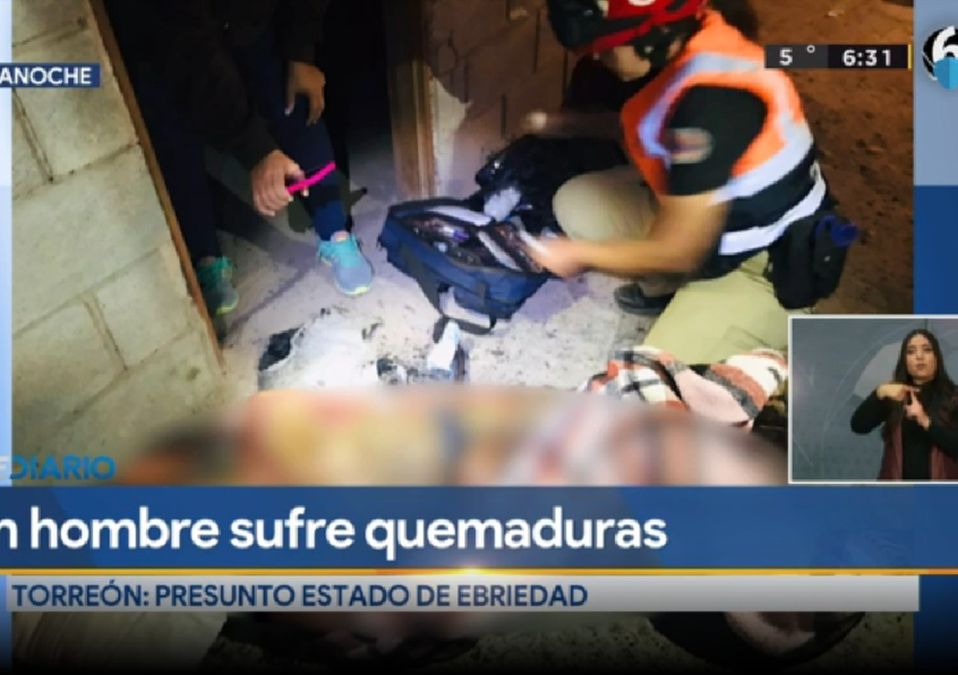 Hombre sufre graves quemaduras por incendio en Torreón