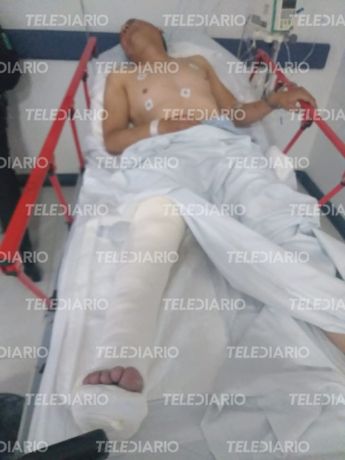 El hombre que disparó contra su expareja en una gasolinera de Puebla fue herido en una de sus piernas / Miguel Ceballos