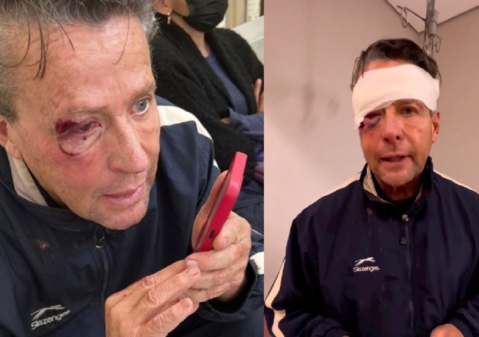 Alfredo Adame tiene tres fracturas de cráneo