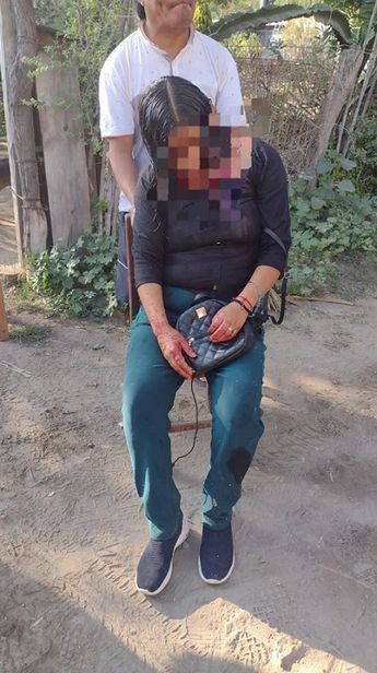 Graciela Alfaro fue asistida por sus vecinos, quienes llamaron al número de emergencias al notar sus heridas / Cortesía