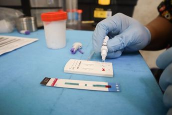 Realizar pruebas de enfermedades de transmisión sexual de manera regular es un método para prevenirlas. | Archivo