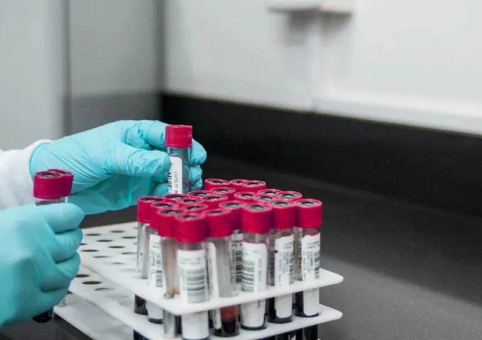 Se han confirmado 147 casos de viruela del mono en México: Ssa