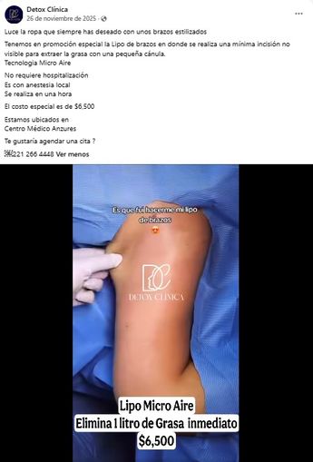 Las redes sociales y precios muy bajos eran la vía principal mediante la cual 'Detox Clínica' buscaba ganar pacientes / Facebook: Detox Clínica