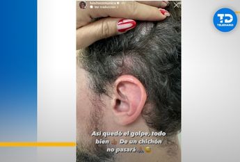 Golpean a Luisito Comunica