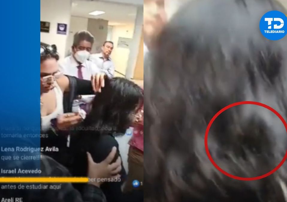 Captan chinche en el cabello de alumna de la UNAM / Especial