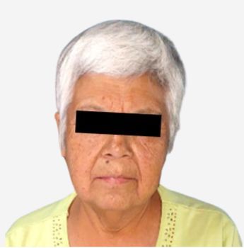 Mujer de 70 años detenida en hidalgo por narcomenudeo.
