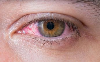 ¿Por qué siento comezón en los ojos y lagrimeo? Esto dice especialistas | Especial