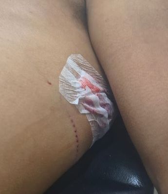 La madre del afectado acudió al lugar tras recibir el aviso de su nuera y encontró al joven tirado en la vía pública con la ropa ensangrentada.
