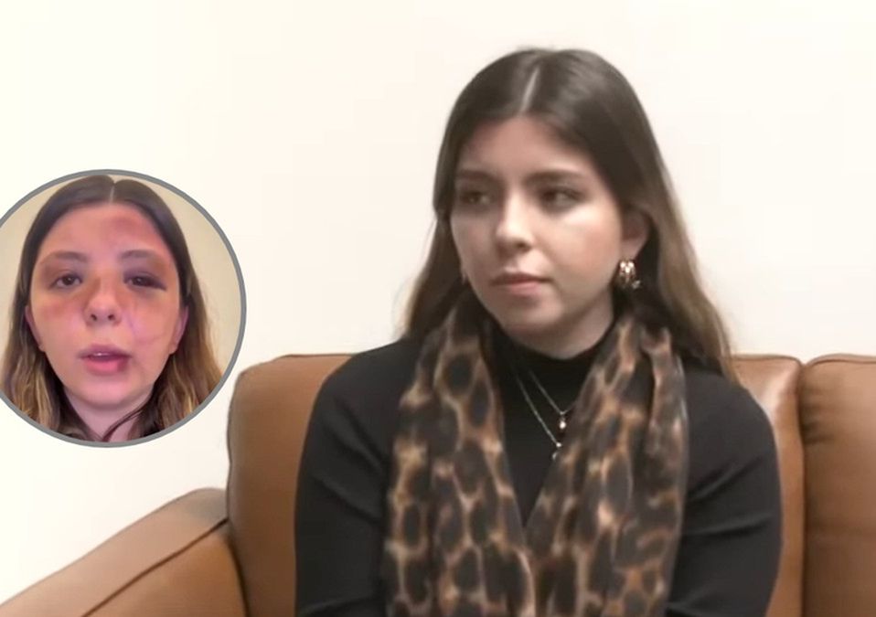 "Tengo un sentimiento de intranquilidad, miedo y pesadillas", indica Caterina tras agresión de su exnovio en CdMx. / Telediario