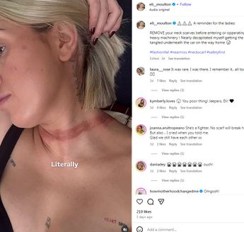 Influencer preocupa a sus fans tras sufrir fatal accidente.