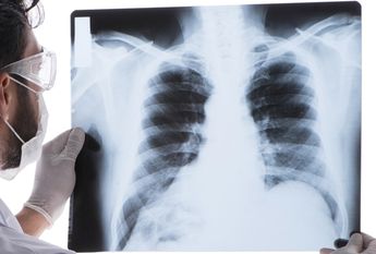 Científicos crean fármaco que evita la propagación del cáncer de pulmón