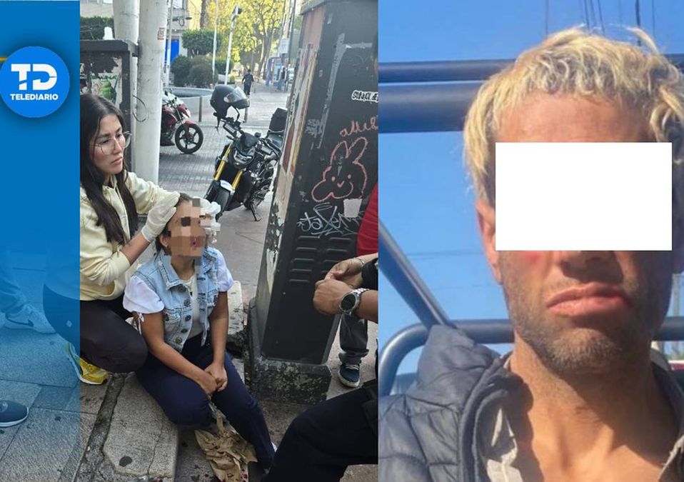La mujer fue agredida de manera repentina y sin mediar palabra por el sujeto/ Especial