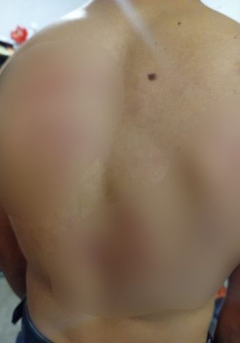 Durante el ataque, intentó resguardarse en una taquería, donde solicitó apoyo sin obtener ayuda de los trabajadores. | Jesús Villegas