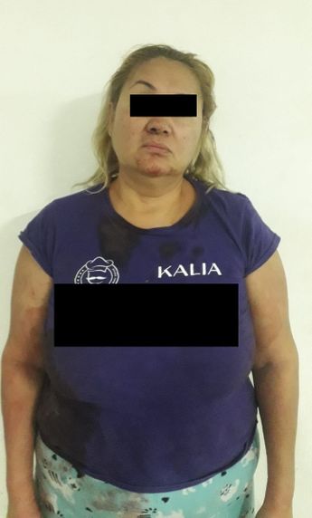 El hijo de la presunta agresora alertó a la policía sobre lo sucedido. | Cortesía